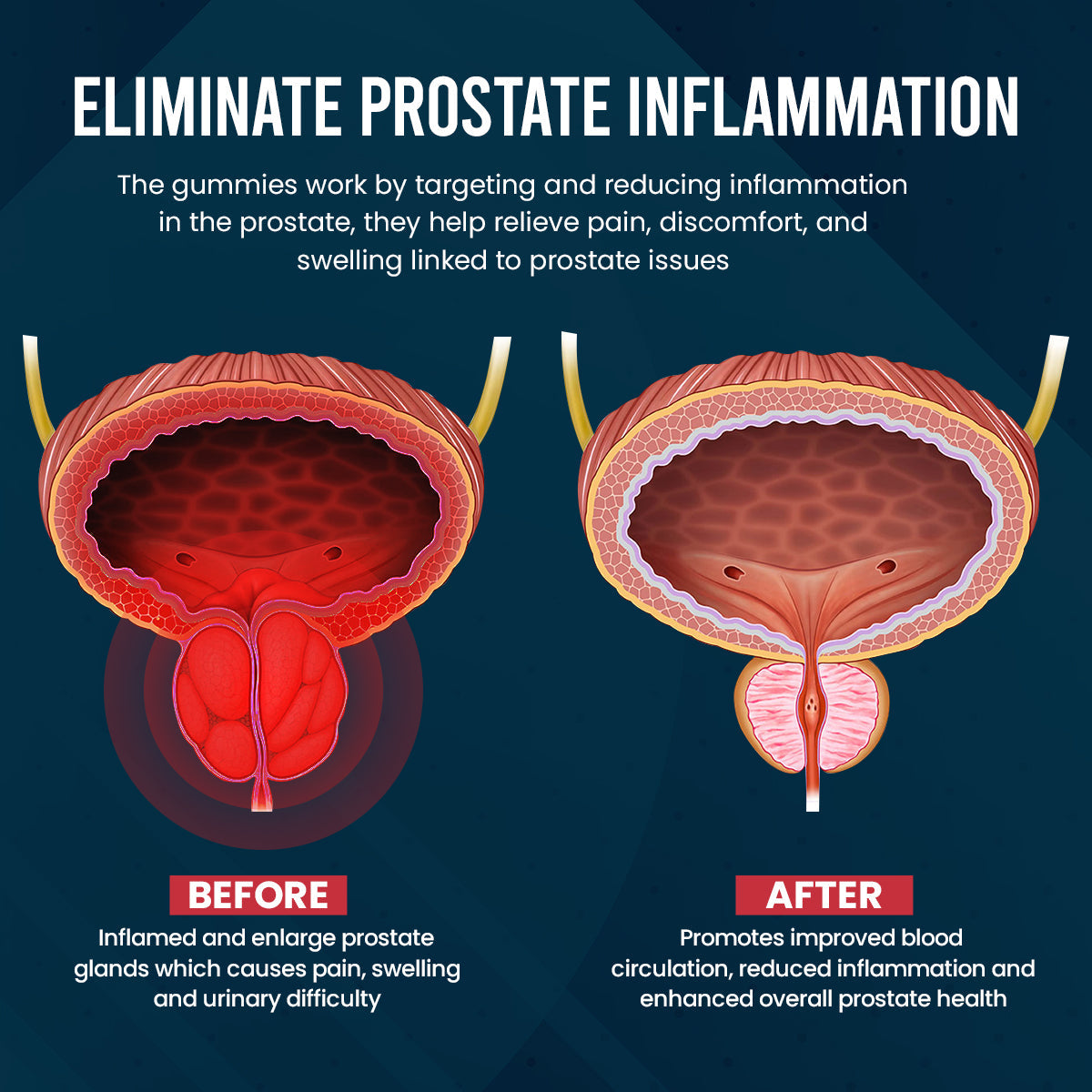 Luhaka™ ProstaGuard Prostate Relief Gummies ⚙️1.03